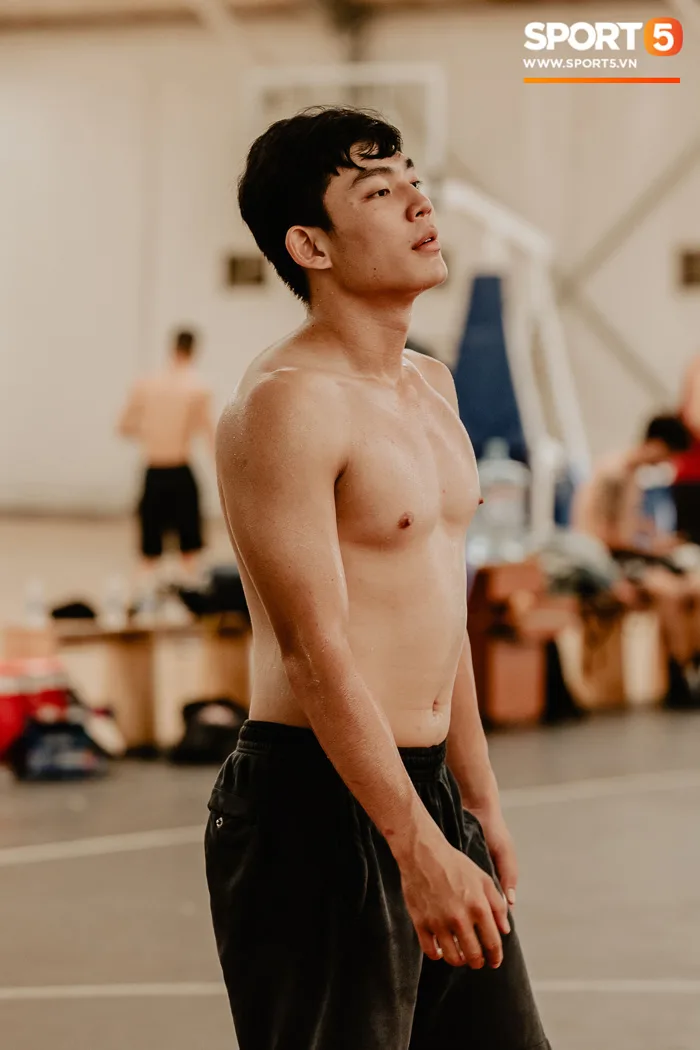 Bỏng mắt